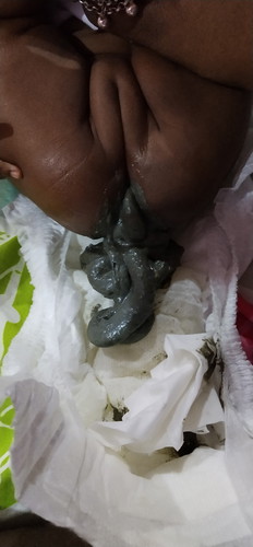 baby poop very dark colour