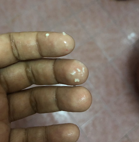 Keputihan?
