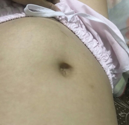 สอบถามแม่ๆหน่อยค่ะ