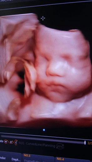 cara menaikan sedikit BB bayi