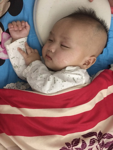 Em bé nhà mình 3 tháng tuổi bị nổi mẩn đỏ trên mặt.mọi ng cho mình biết cách xử lý với ạ ❤️