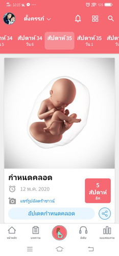 อายุครรภ์ 35 w