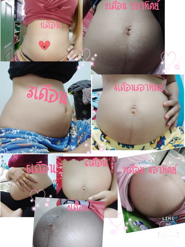 ลงไว้แจ้งเตือนทุกการตั้งครรภ์มีเรื่องราว รัก