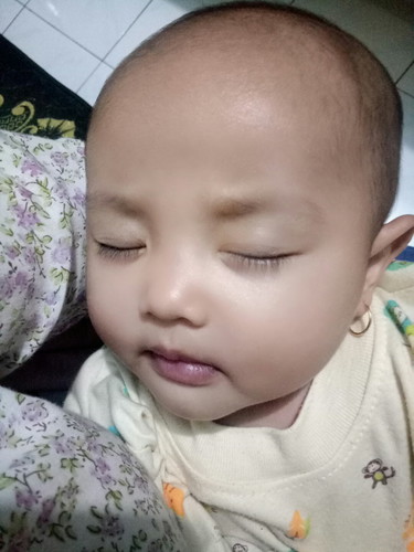 memotong bulu mata