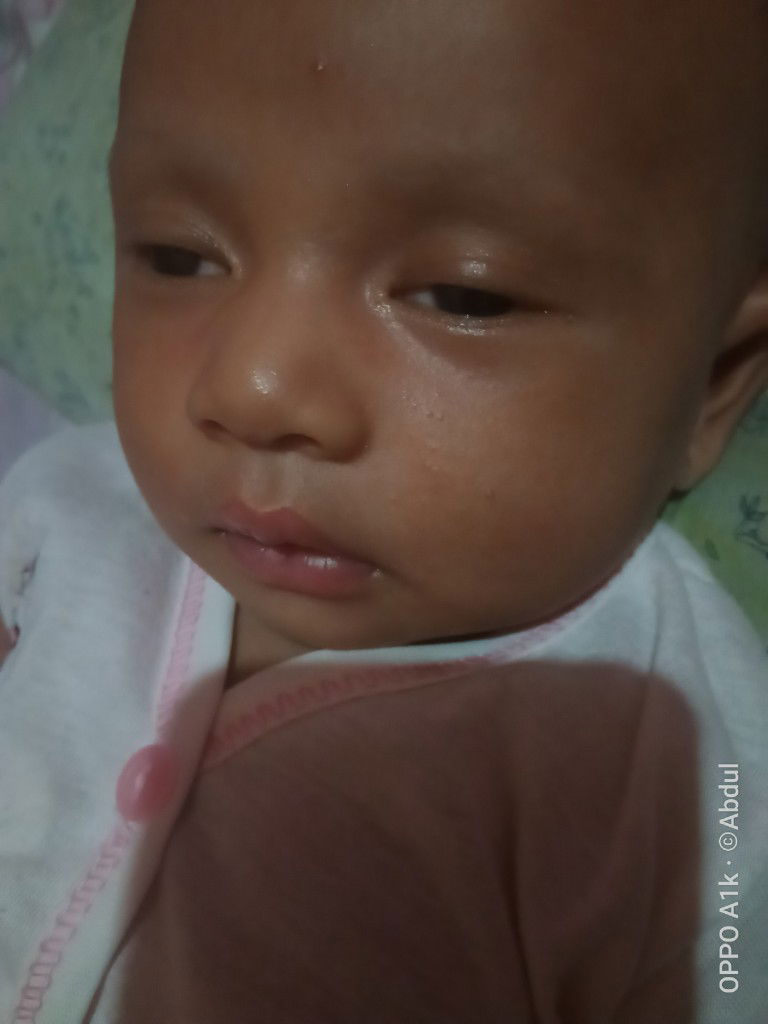 mata melek saat tidur