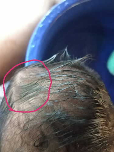 หัวน้องโน