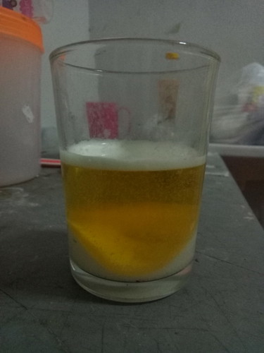 ทดสอบเพศ