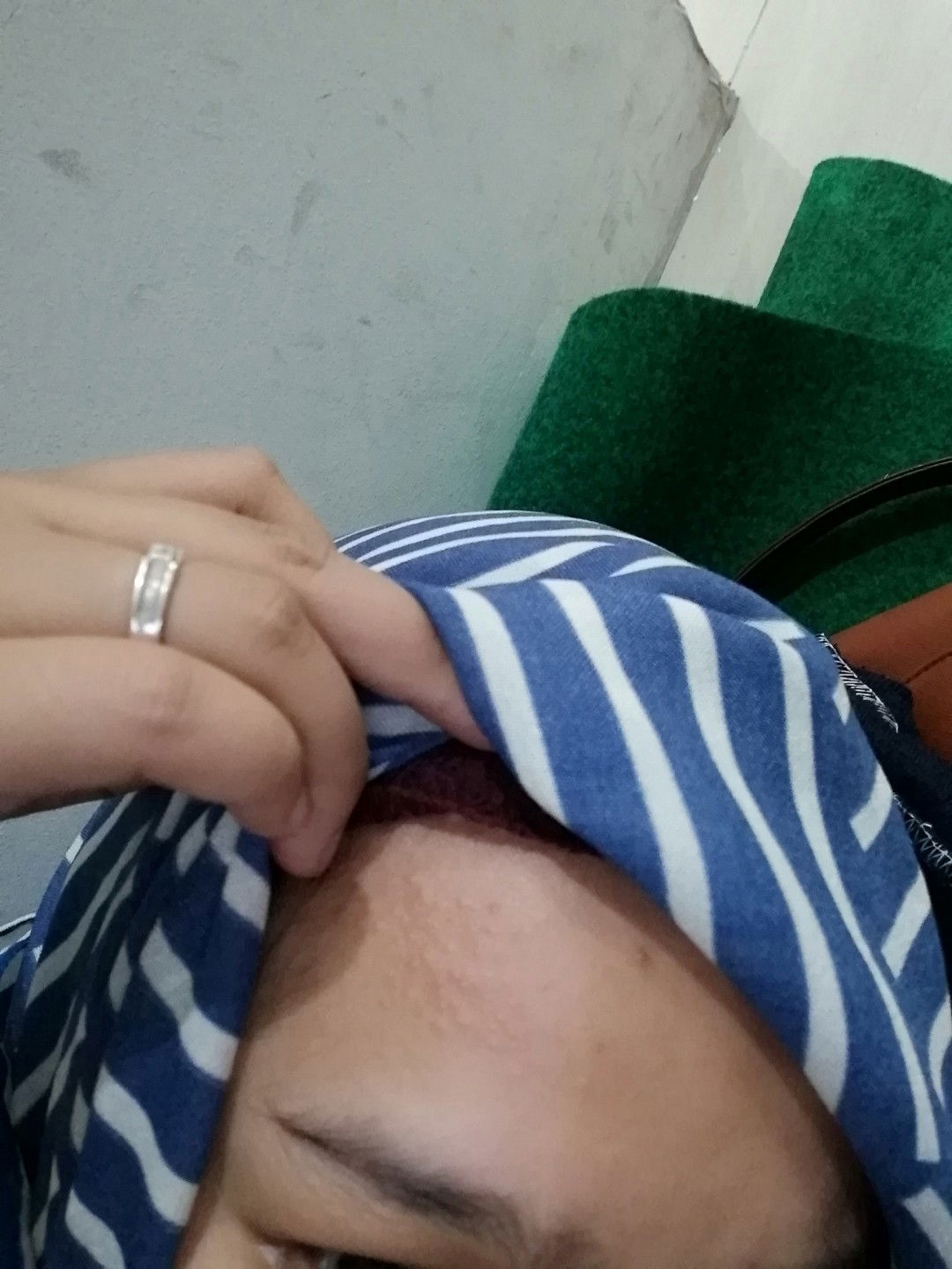 Kepala Bruntusan Pas Hamil