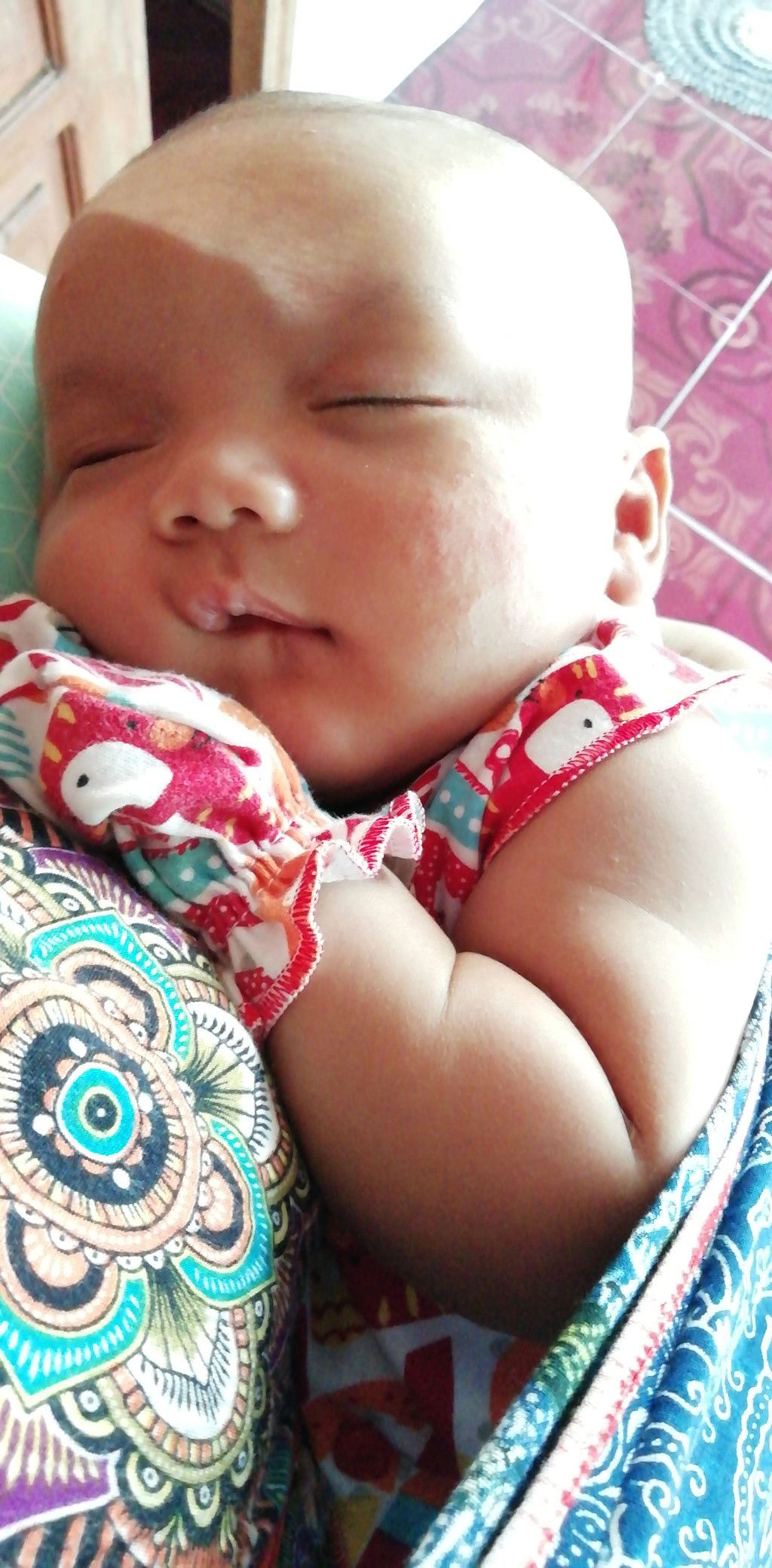 Bintik2 Merah Di Pipi