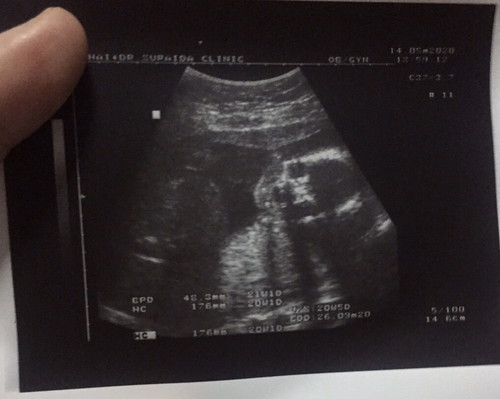 ทีมลูกสาว