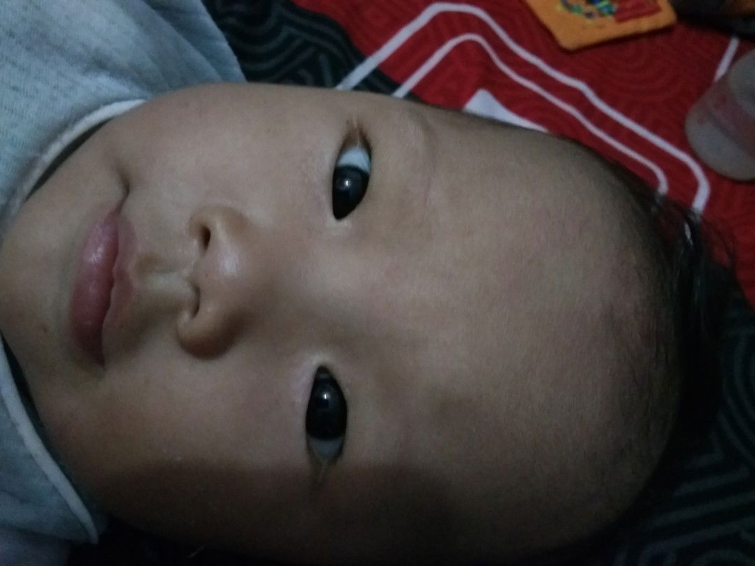 bintik putih di sudut mata