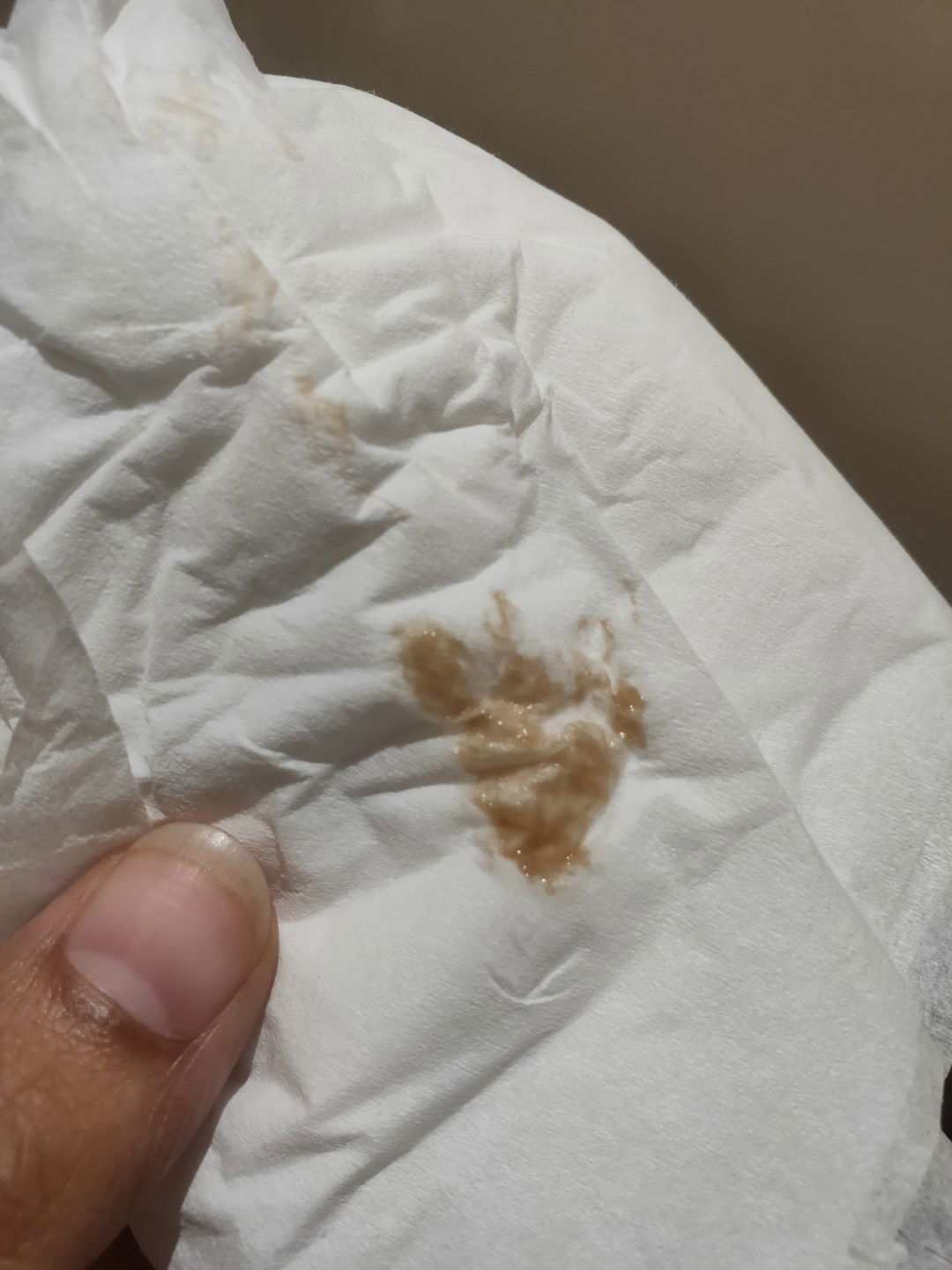 ตกขาวสีน้ำตาล