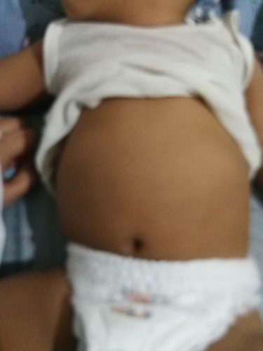 Normal Tummy