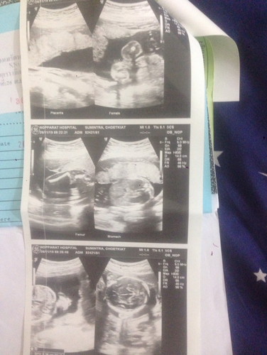 ภาพลูก