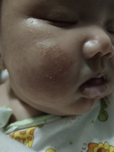 สอบถามผิวลูกหน่อยคร้าาาา