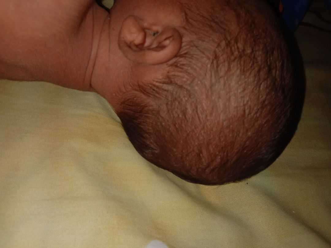 bintik putih bayi baru lahir 10hari