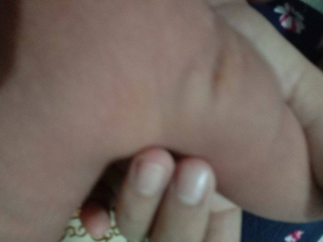 bentol kuning atasnya