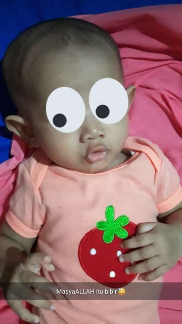 cara menumbuhkan rambut