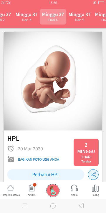 BB bayi 2,5 kg , disuruh dokter banyak minum susu klo perlu banyak makan es krim,,!