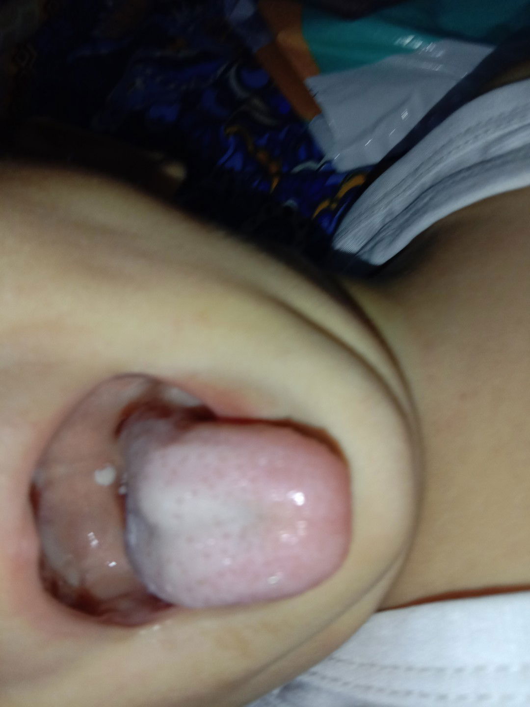 bintik putih tenggorokan