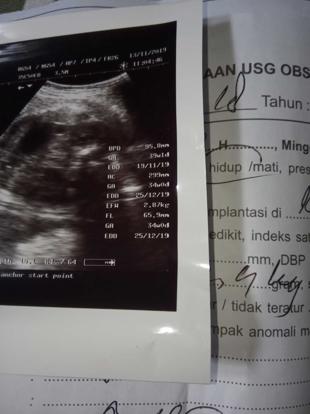 kehamilan