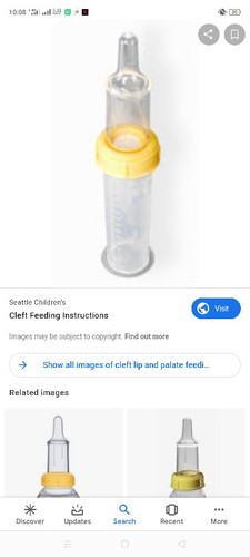 for cleft lip & palette