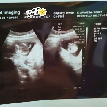 lihat umur kandungan di usg