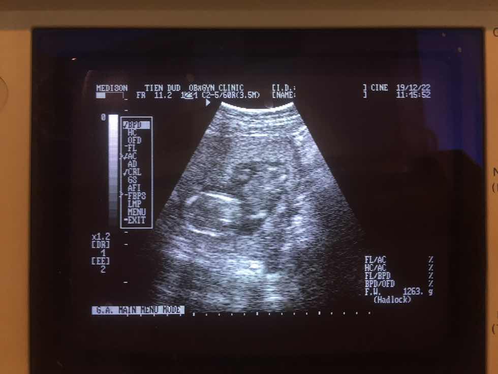 เจอกันอีกแล้วจ้า ?