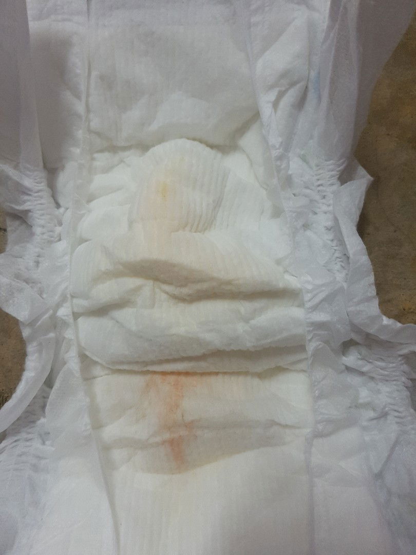 ลูกฉี่เป็นสีชมพู