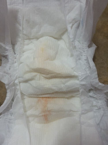 ลูกฉี่เป็นสีชมพู