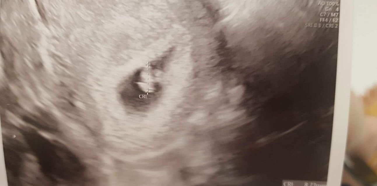 จากวันนั้นถึงวันนี้