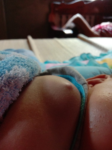 มันคือตุ่มอะไร