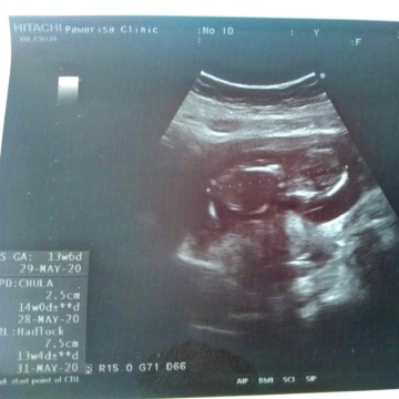 14w