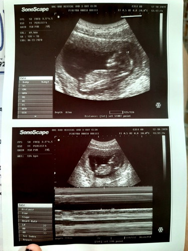 Boy or Girl