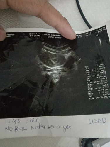 tanya pasal scan