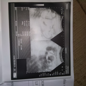 อยากสอบถามแม่ๆทุกคนค่ะ