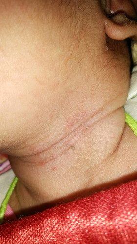 leher bayi