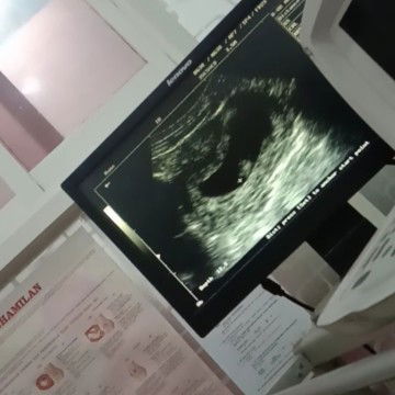 janin terluhat kecil