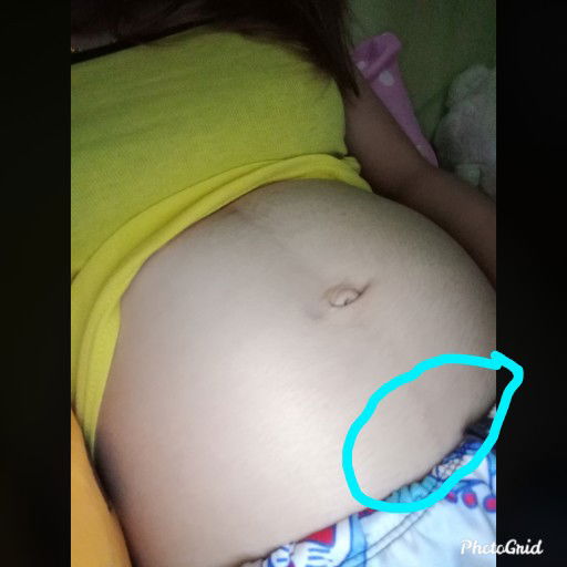 เจ็บหน่วงๆ