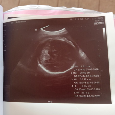 ลูกกลับหัวรึยัง
