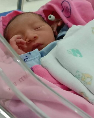 คลอดก่อนกำหนด