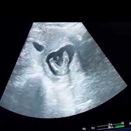 Baby june 2020