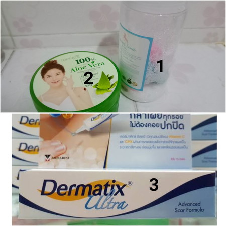 เรื่องท้องแตกลาย