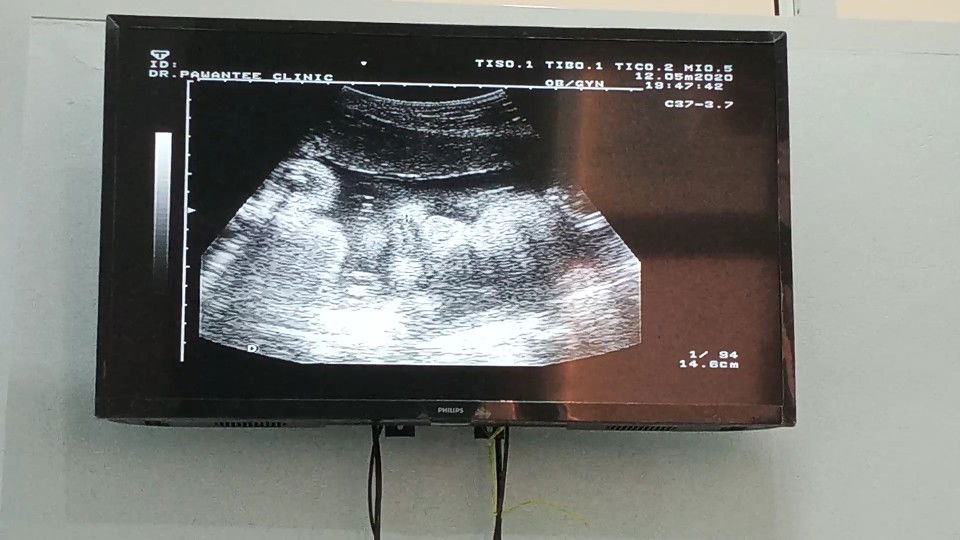 sudtanee thonemery profile icon