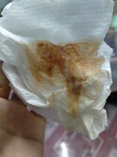 มีเลือดสีน้ำตาล