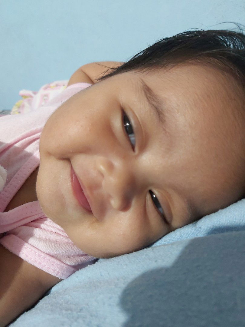 nakalmot ng kuko ung mata ni baby