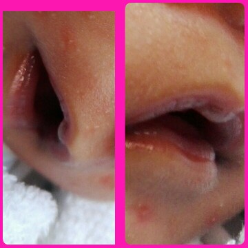 newborn lips