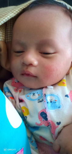 ruam