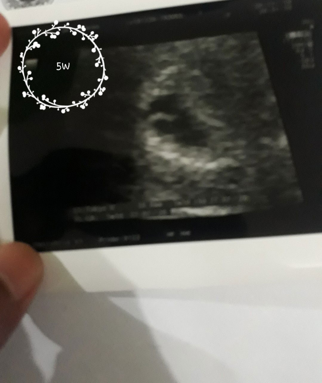 Alhamdulillah adek sehat