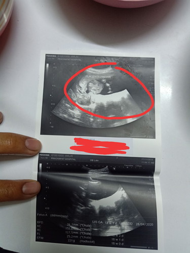 18วีค2